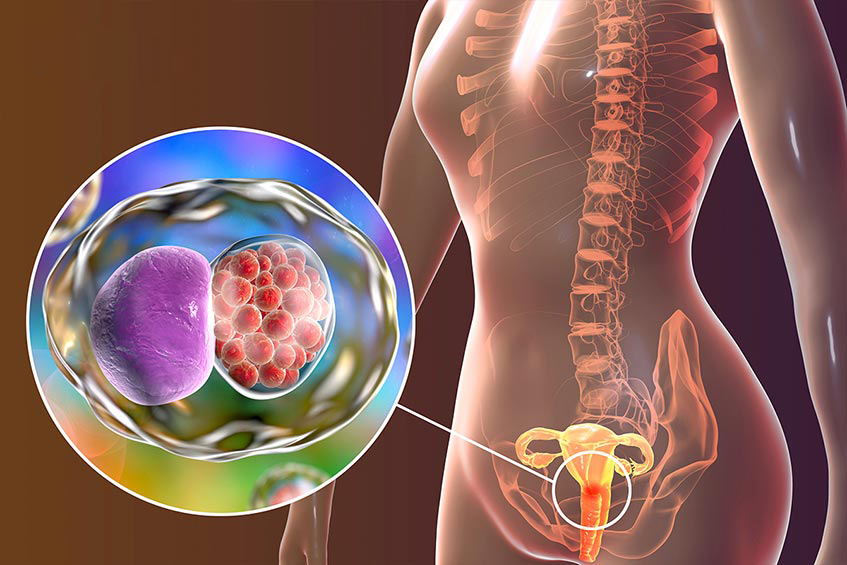 viem-am-dao-la-benh-ly-thuong-gap